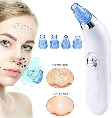 Derma Suction Pore Cleaning Device in Sri Lanka